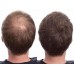 Пудра-загуститель волос Toppik (12 г.) - стандарт, средне-коричневый